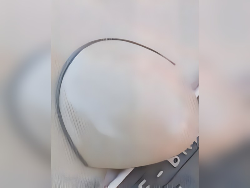 Foto: Nariz de Placa - Nariz de Placa Reduzido Zwitter e Oval